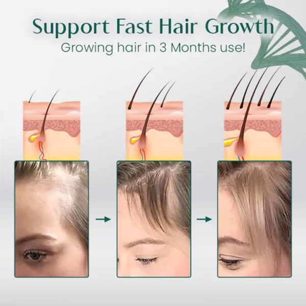 Ceoerty™ TSUYOI Hair Growth Spray - Image 4