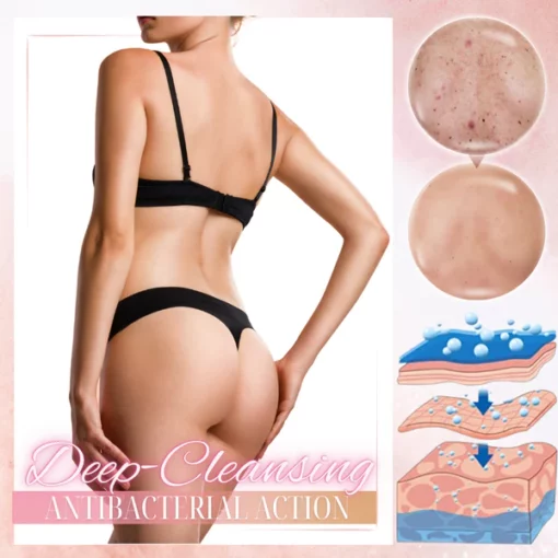 Dobshow™ Body Acne Treatment Roller - Image 4