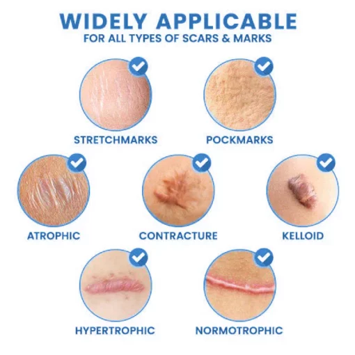 ScarFree™ Professional Advanced Cool Scar Treatment - Image 5