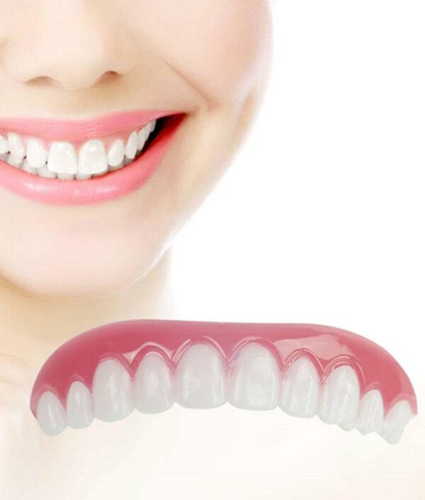 Instant Teeth Veneer - Image 2
