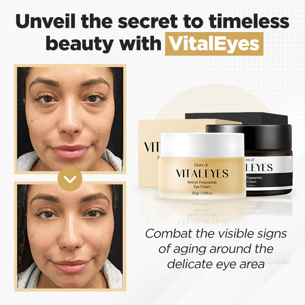 Biancat™ VitalEyes Retinol Polypeptide Eye Cream - Image 4