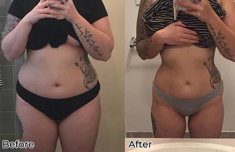 Fivfivgo™ BeeVenom Abnehmendes Fußpflaster - Image 4