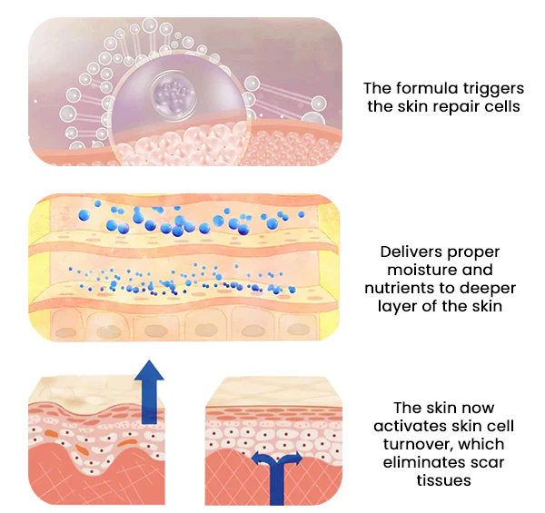 BeevHeal™ Scar Removal Spray - Image 4