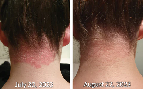 GFOUK™ PsoriX Bee Venom Cream - Image 7