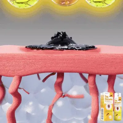 Seurico™ Bee Venom Power Mole & Wart Remover Spray - Image 4