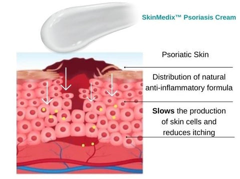 SkinMedix™ Natural Herbaceous Plants Psoriasis Cream - Image 19