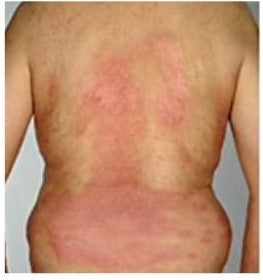 SkinMedix™ Natural Herbaceous Plants Psoriasis Cream - Image 18