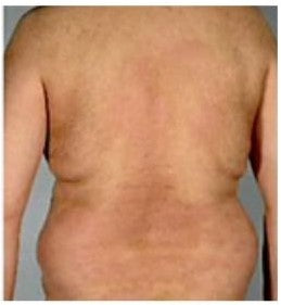 SkinMedix™ Natural Herbaceous Plants Psoriasis Cream - Image 17