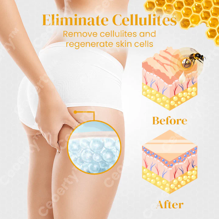 Ceoerty™ BootyBeaute Bee Venom Body Cream - Image 4