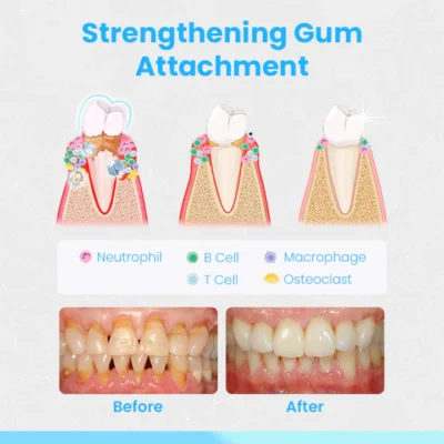 Ceoerty™ RevitaDent Gum Repair Strips - Image 8