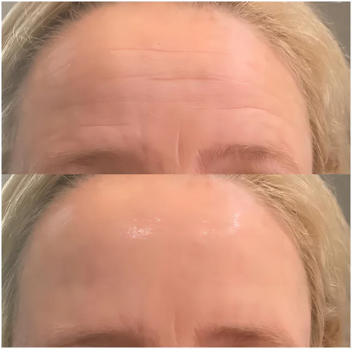 SkinRevive™ Facial Botox Serum - Image 9