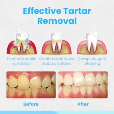 Ceoerty™ RevitaDent Gum Repair Strips - Image 6