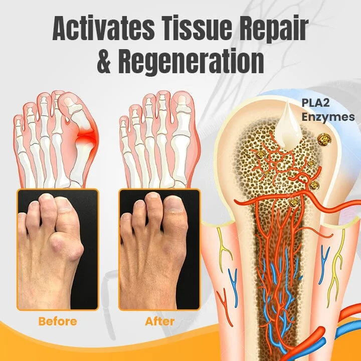 Ceoerty™ HalluxWell BeeVenom Therapy Cream - Image 7