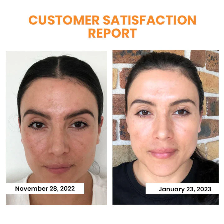 LOVILDS™ Korean Dermalayr Technology Soluble Collagen Film - Image 9