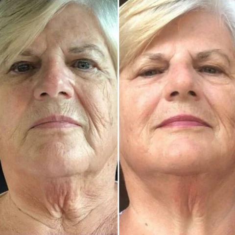 Fivfivgo™ Botox Anti-Ageing-Serum - Image 11