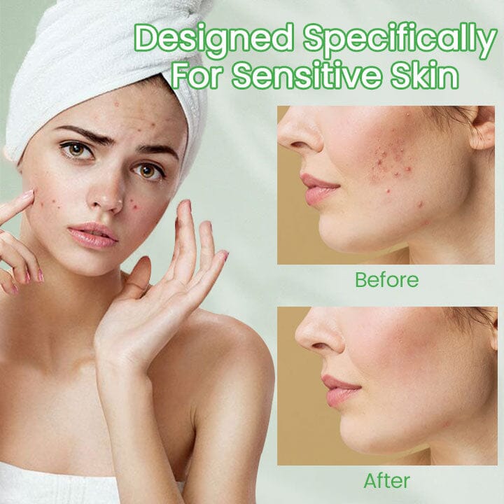 Ceoerty™ Nightly ClearSkin Patch - Image 4