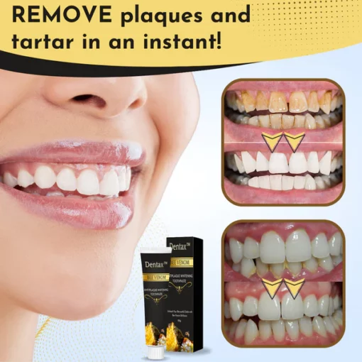 Dentax™ Bee Venom Antiplaque Whitening Toothpaste - Image 4