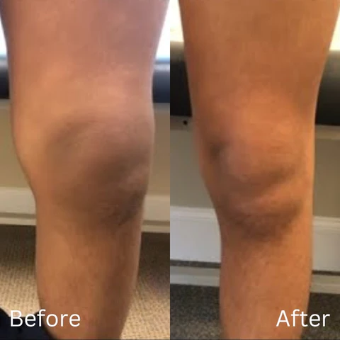 Oveallgo™ JointCare Pain Relief Spray - Image 5