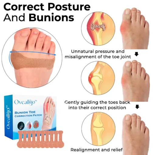 Oveallgo™ Bunion Toe Correction Patch - Image 5