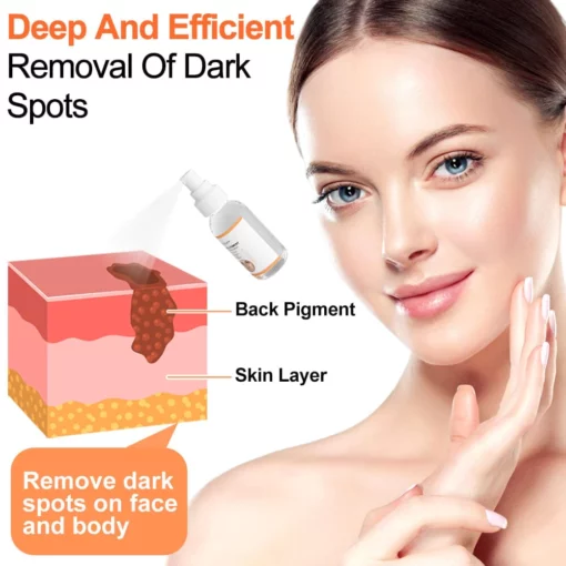 GFOUK™ Retinol Pigment Correcting Spray - Image 6