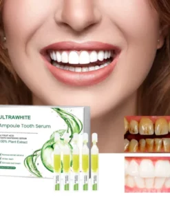 UltraWhite™ Tooth whitening and cleaning essence