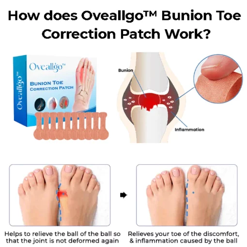 Oveallgo™ Bunion Toe Correction Patch - Image 4