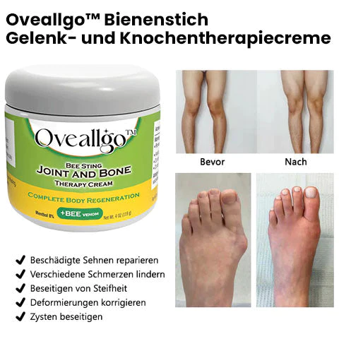 Oveallgo™ Bee Sting Gelenk PURI - und Knochentherapiecreme – vollständige Körperregeneration - Image 2