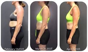 GFOUK Active Caffeine Anti-Swelling Cream - Image 5