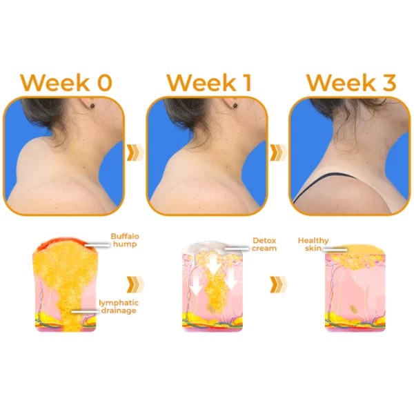 GFOUK™ Sculpting Lymphatic Drainage Detox Cream - Image 5