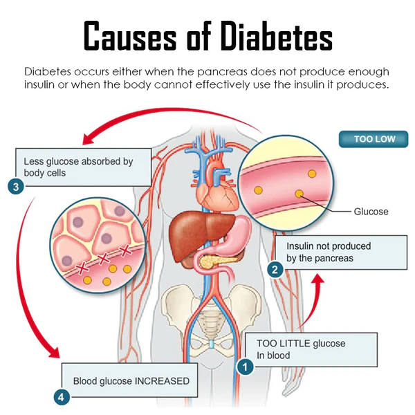 Ricpind ReliefDiabetes BodySculpting Hand Strap - Image 7