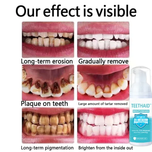 PlaqBite™ Plaque Removal Anti-Cavity Mousse Toothpaste - Image 7