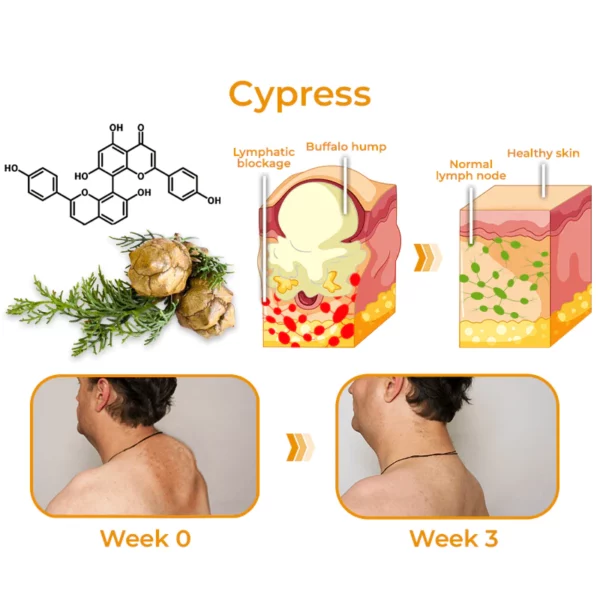 GFOUK™ Sculpting Lymphatic Drainage Detox Cream - Image 4