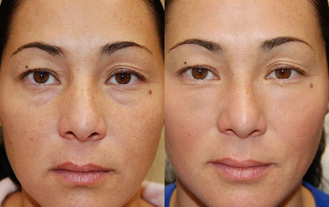 EyeDelight™ SnakeVenom Wrinkle Repair Eye Cream - Image 6