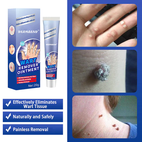 DermaEnd™ Wart Remover Herbal Ointment 100% Natural - Image 2
