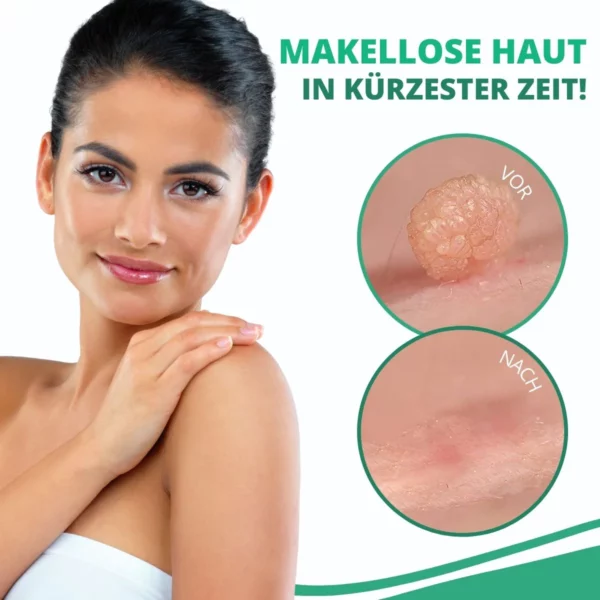 SkinPro™ Hauttag-Entferner-Pflaster - Image 4