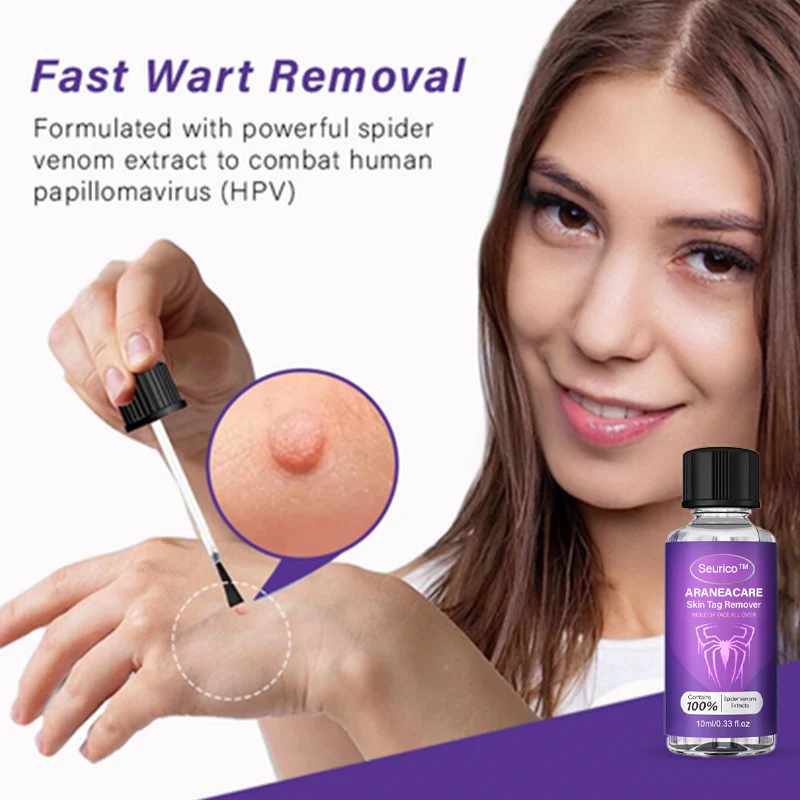 Seurico™AraneaCare Skin Tag Remover - Image 2