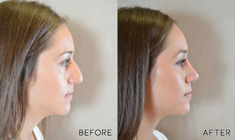 Fivfivgo™ Nose Defining Serum - Image 5