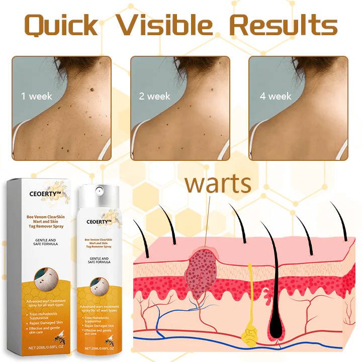 Ceoerty™ Bee Venom ClearSkin Wart and Skin Tag Remover Spray - Image 6