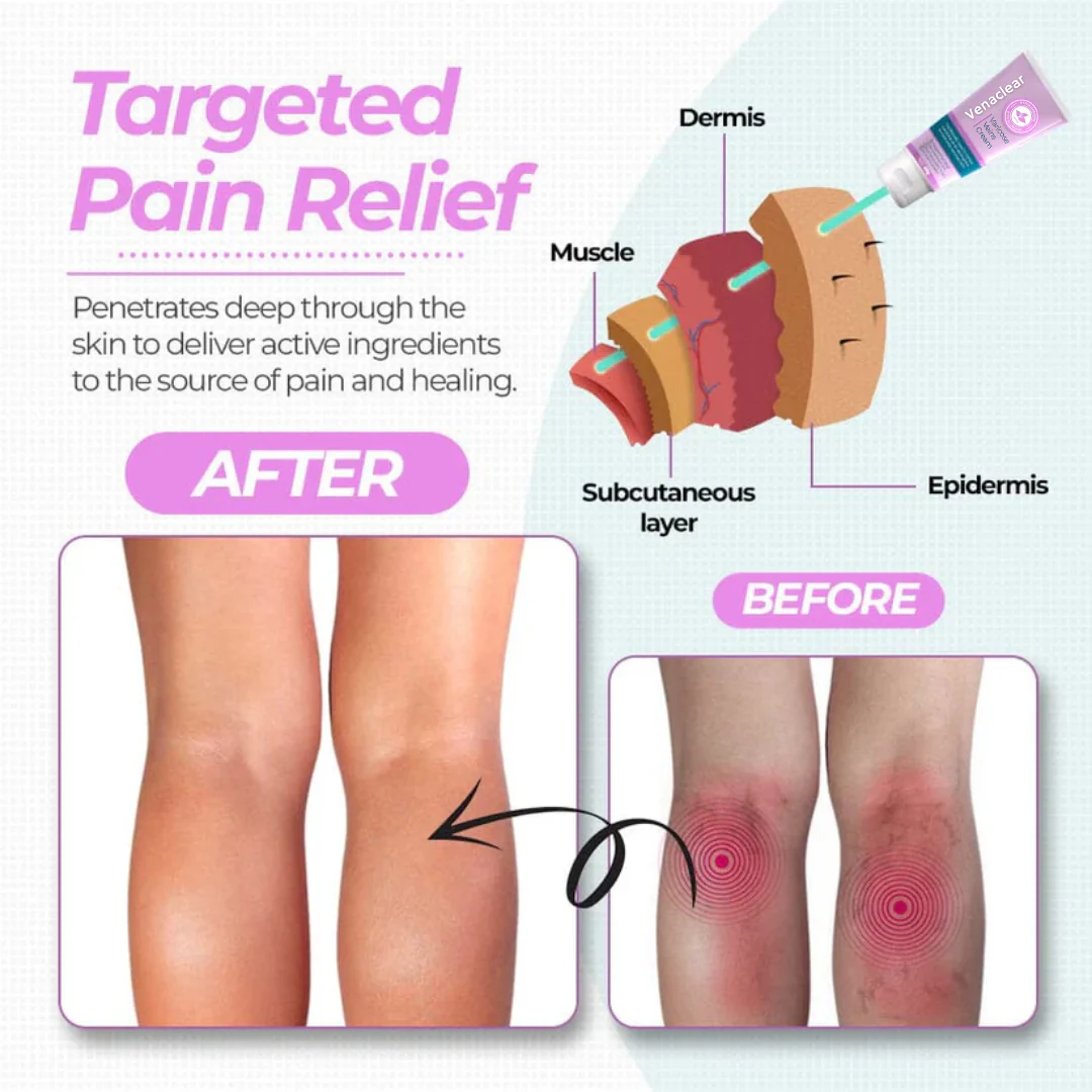 Venaclear™ Varicose Veins Cream - Image 8