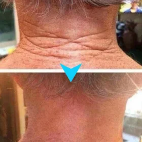 Tiworld™ SkinFirming Rejuvenating Serum - Image 18