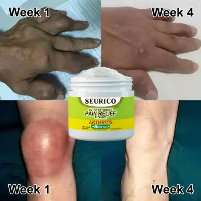 Seurico™ Bee Venom Joint & Bone Therapy Cream - Image 9