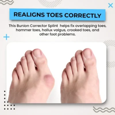 Gopura™ 3D Bunion Splint Corrector - Image 6