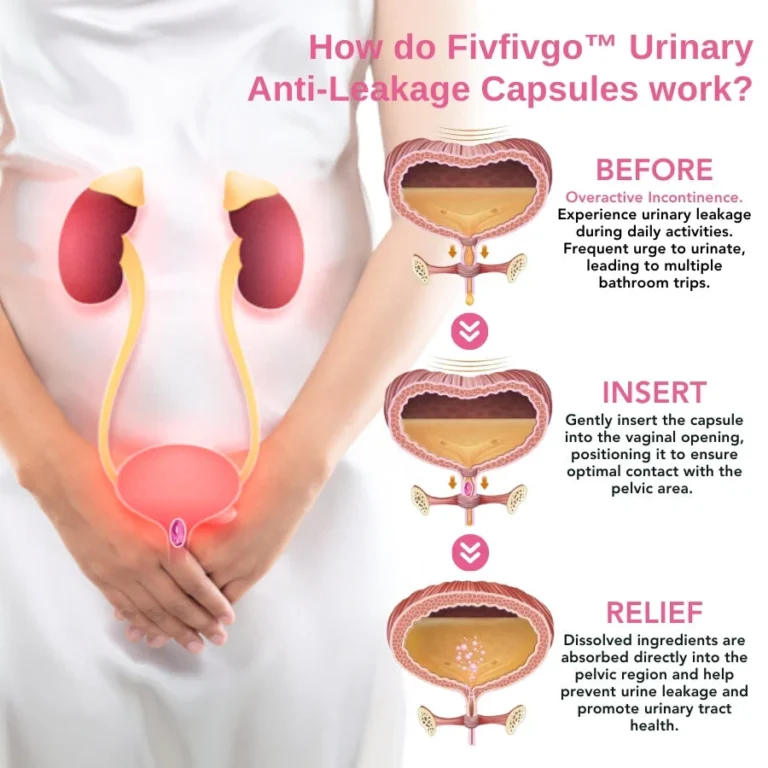 Oveallgo™ Urinary Anti-Leakage Capsules - Image 3