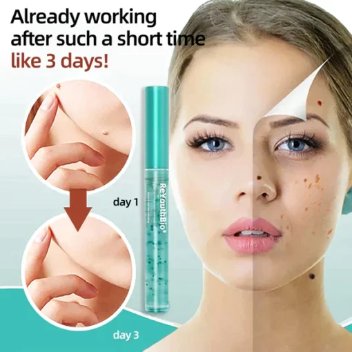 Biancat™Tags & Moles Remover - Image 6