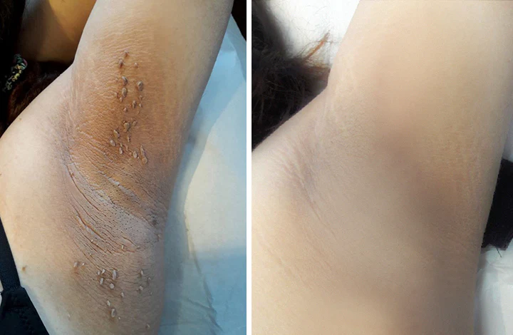 ๐
๐๐๐๐๐โข ๐ฉ๐๐ ๐ฝ๐๐๐๐ ๐พ๐๐๐ ๐๐ซ๐๐๐ญ๐ฆ๐๐ง๐ญ ๐ช๐๐๐๐ - Image 6