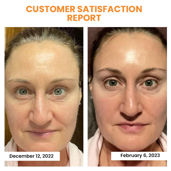 LOVILDS™ Korean Dermalayr Technology Soluble Collagen Film - Image 4