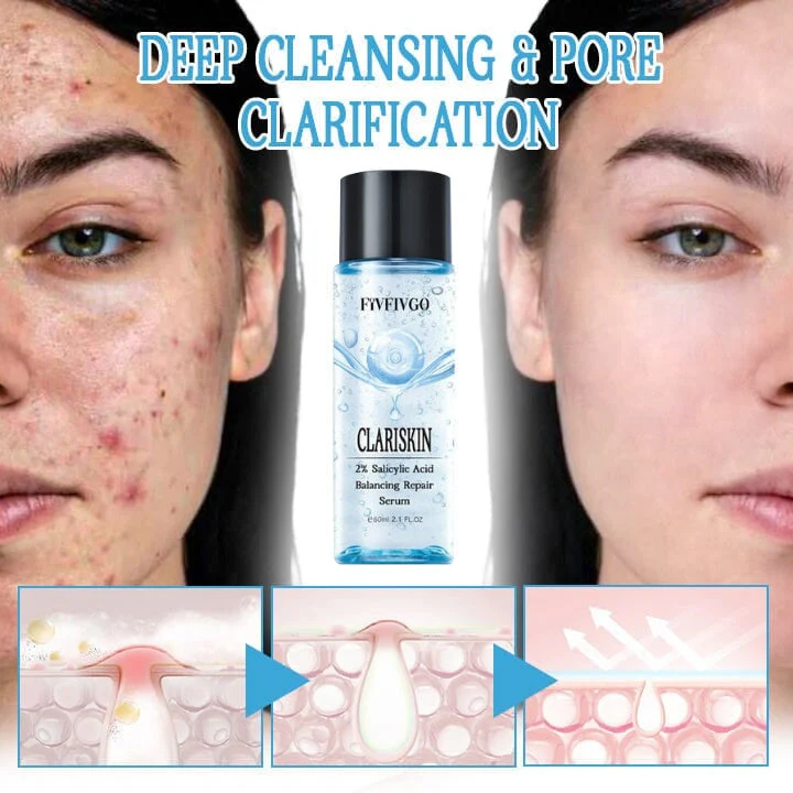 Fivfivgo™ ClariSkin 2% Salicylsäure Ausgleichendes Reparaturserum - Image 3