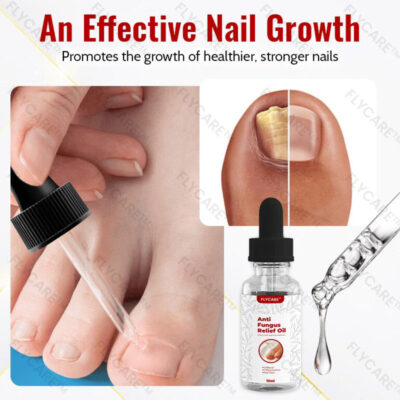 FLYCARE™ Anti-Fungus Relief Oil - Image 5