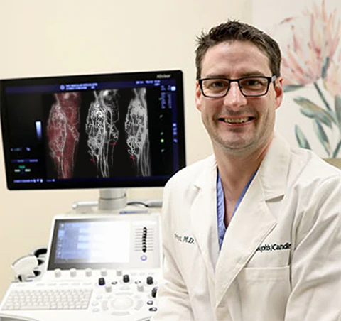 flysmus™ Varico-X Vein Dredge Bee Venom Spray - Image 16