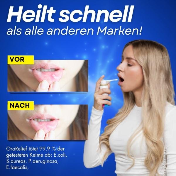 OraRelief™ Mundgeschwür-Spray - Image 6